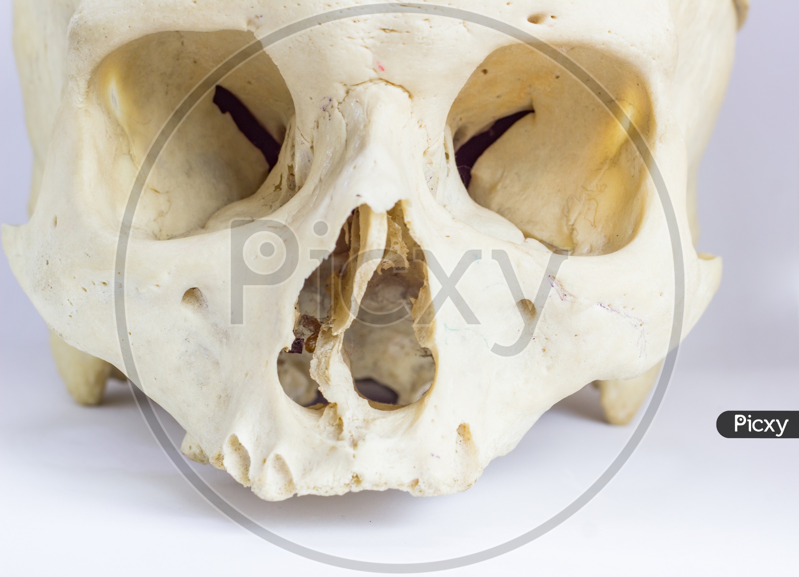 Close Up Macro View Of Human Skull Bone Showing The Anatomy Of Nasal Foramen, Nasal Septum And Orbital Cavity