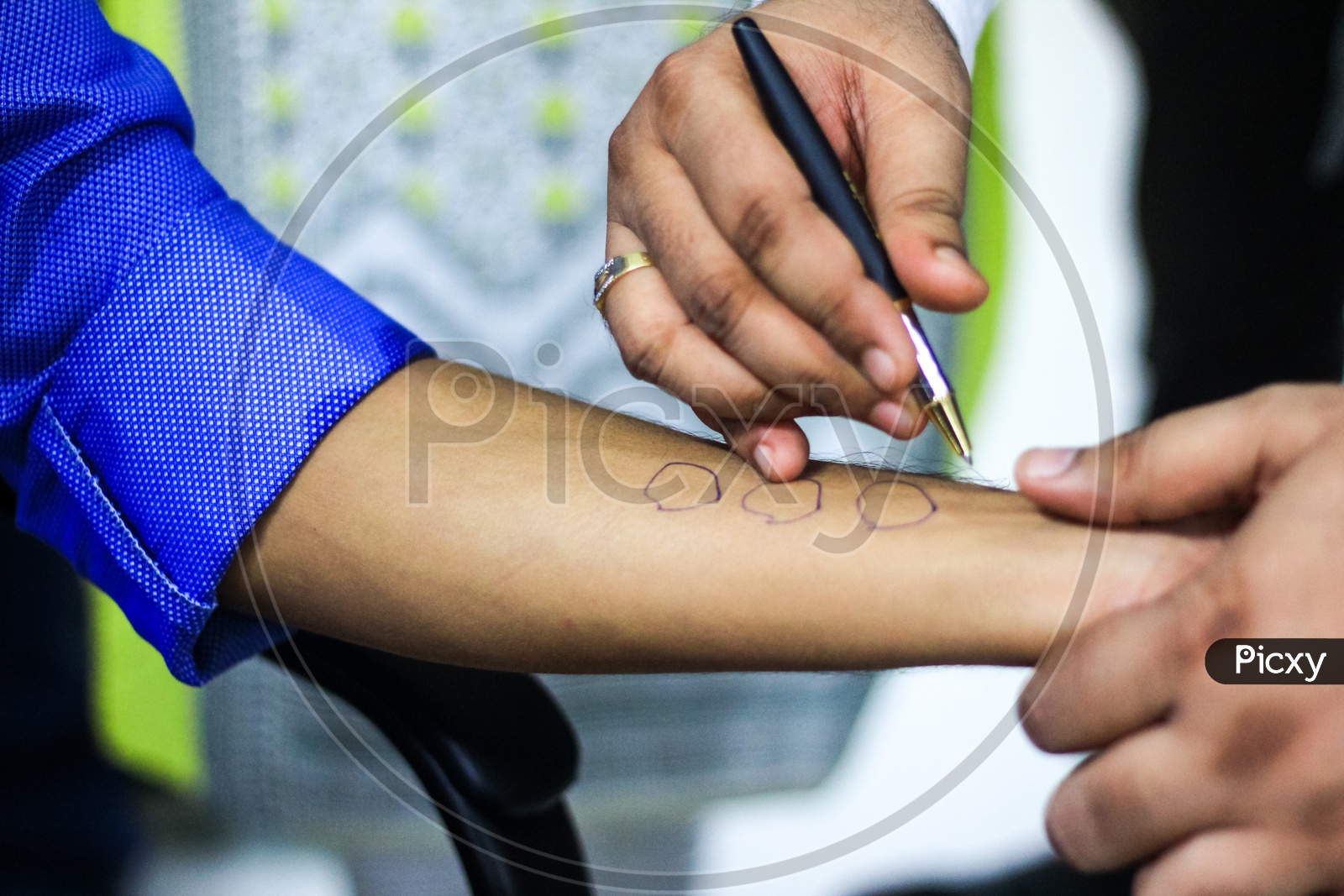 Skin Allergy Test Preparation By Doctor On A Patient Hand Using Allergy Sensitivity Kit