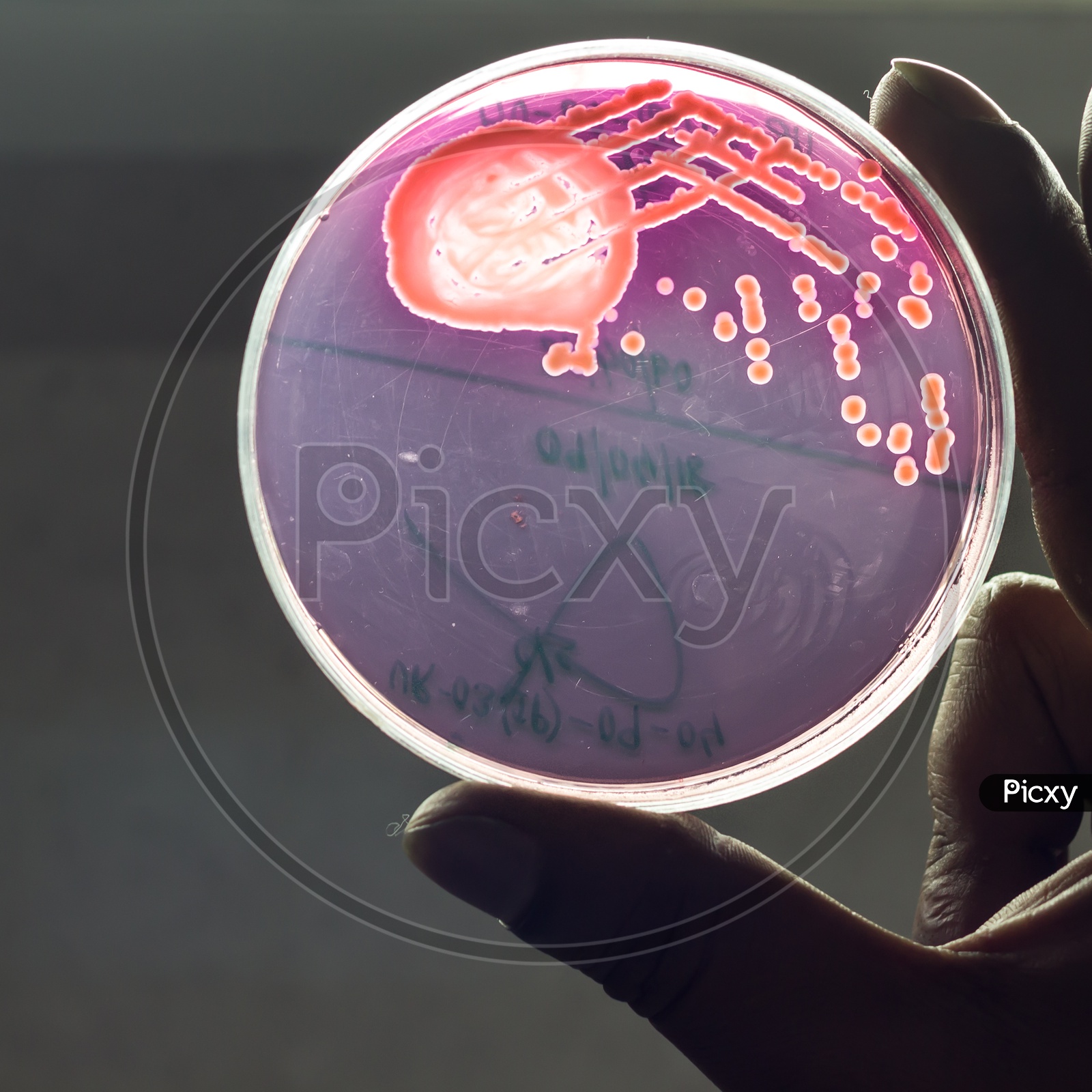 Bacterial Culture Plate Showing Growth Of Bacterial Colony In Mac Conkey Blood Agar Held By Hand