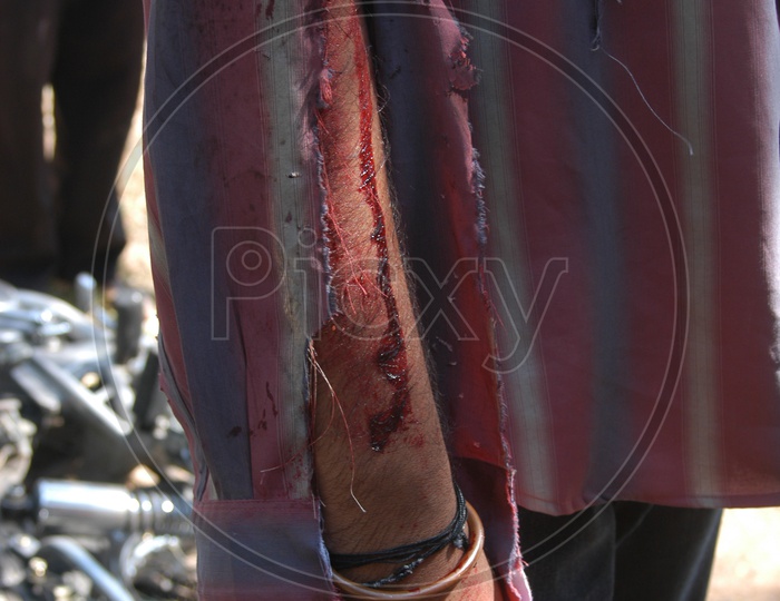 Man Hand With Wounds in a Movie Working Stills