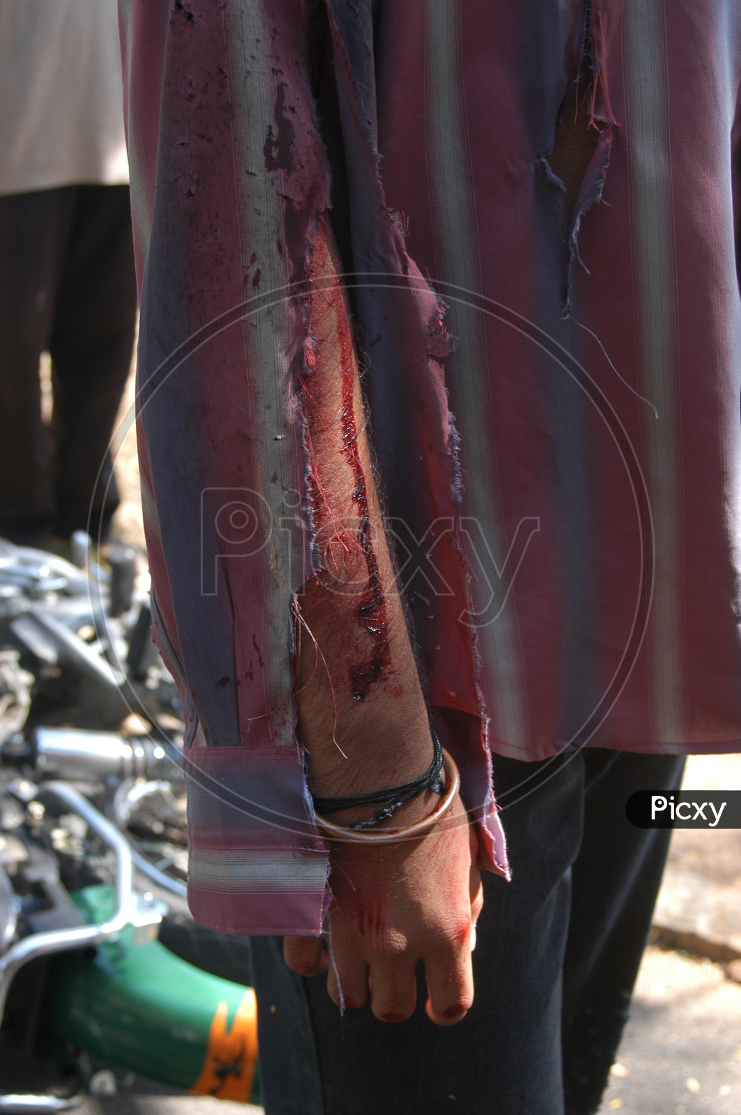 Man Hand With Wounds in a Movie Working Stills