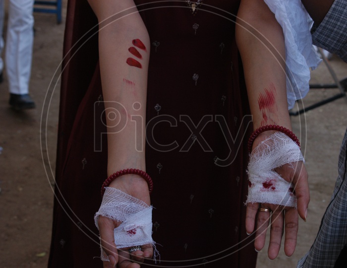 Woman Abuse With Blood Stains To Hands