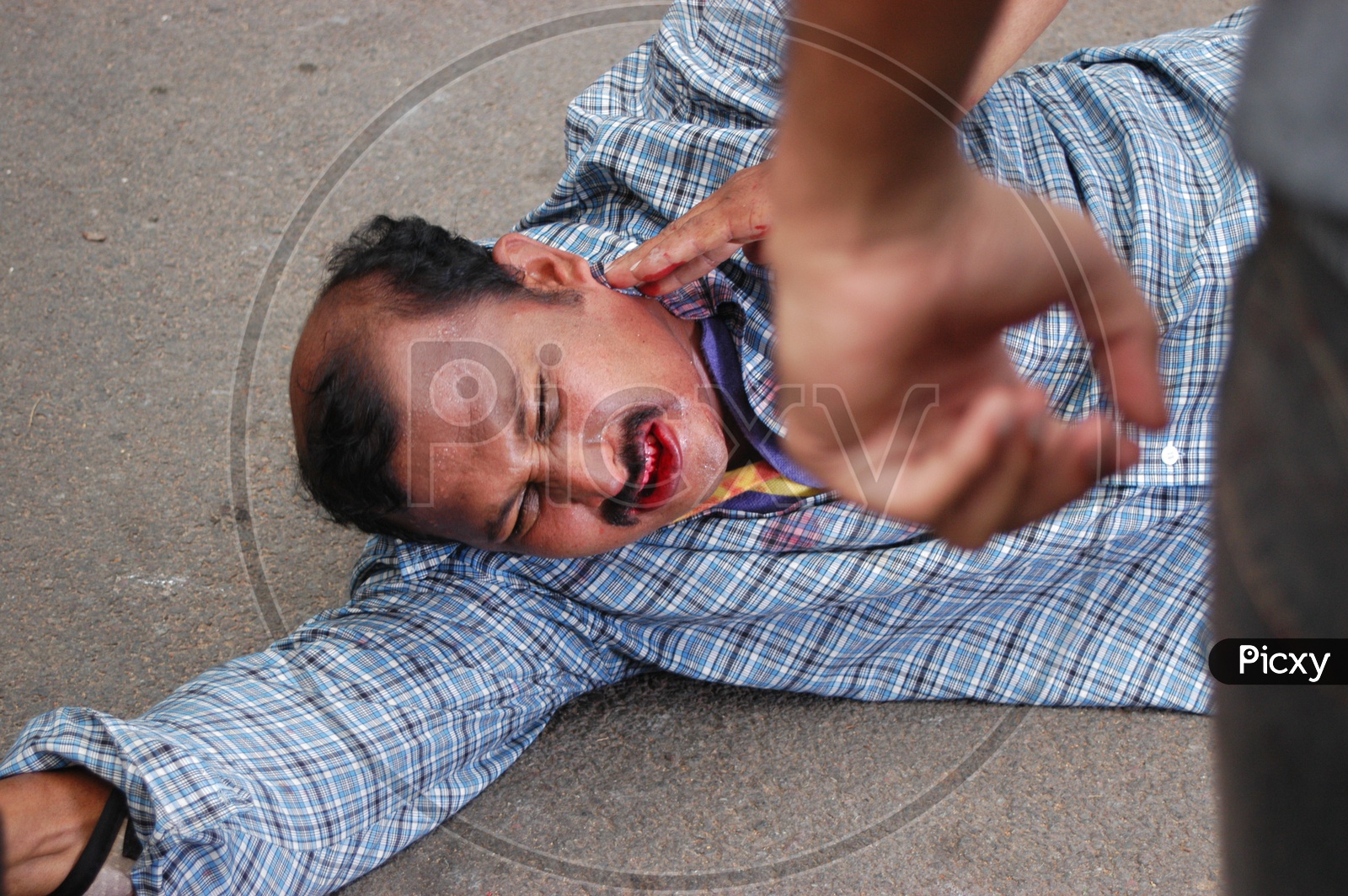 A Man Beaten By Another Man Bleeding Closeup