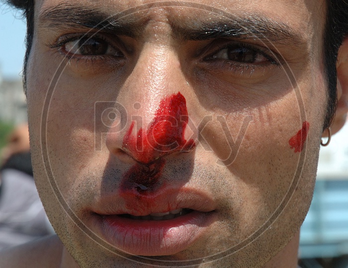 Man With Blood Stains on Face
