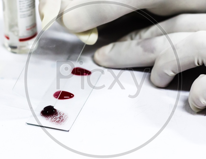 Blood Grouping By Slide Agglutination With A Glass Slide