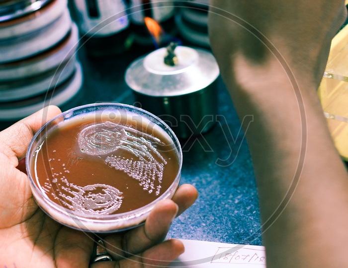 Bacterial Inoculation On A Culture Plate Using Inoculation Loop By Scientist Lab Technician In Microbiology Laboratory