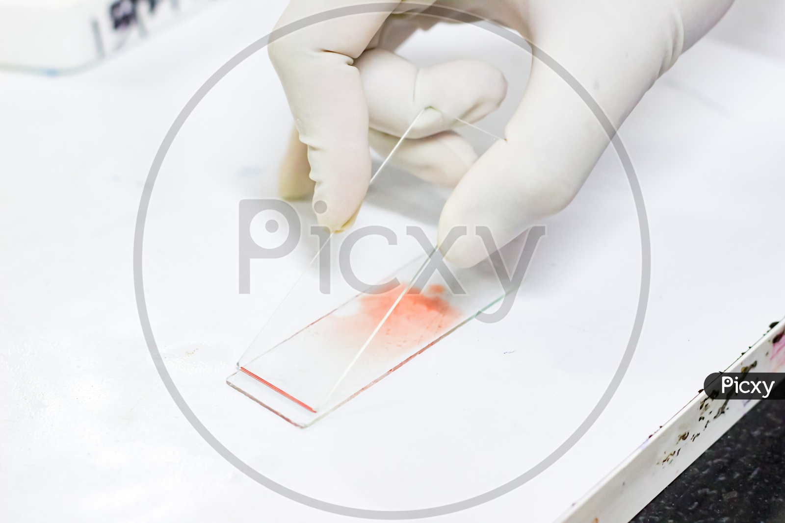 Smear Drawing Of Blood By Glass Slide