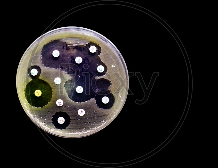 Culture Plate Of Bacterial Growth Showing Antibiotic Sensitivity In Their Colony Pattern Isolated In Black Background