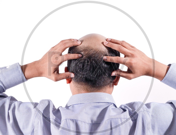 Bald Businessman With His Head On Scalp View From Behind With White Background, Hair Loss