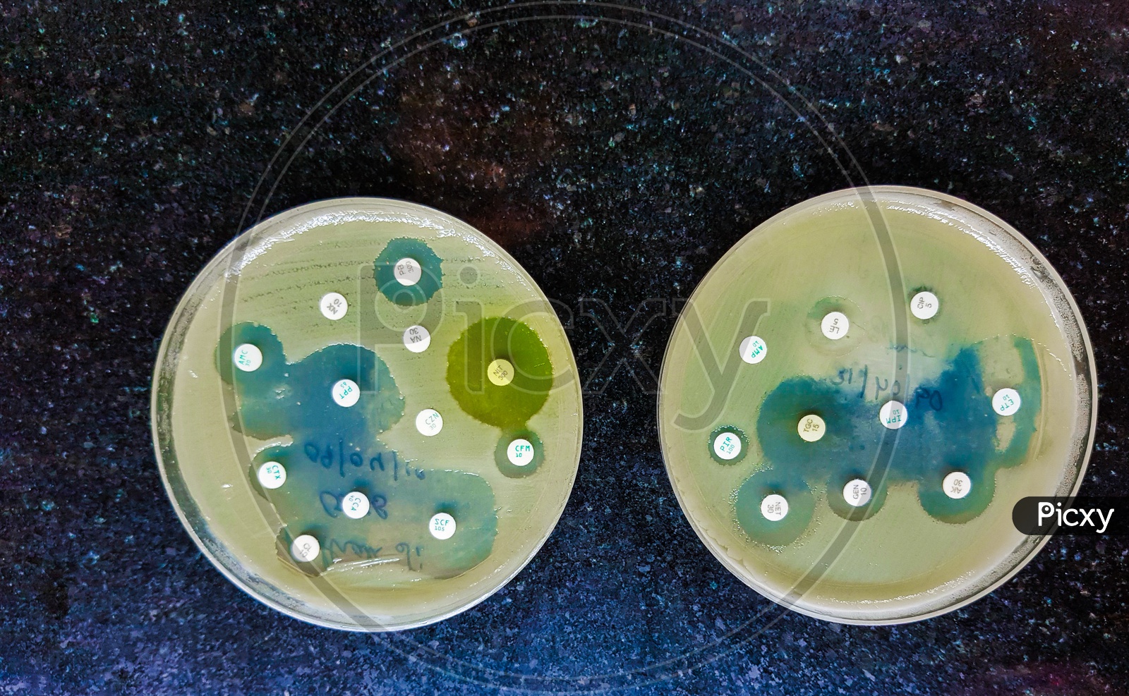 Two Culture Media Plate Showing Bacterial Growth Inhibition Antibacterial Sensitivity