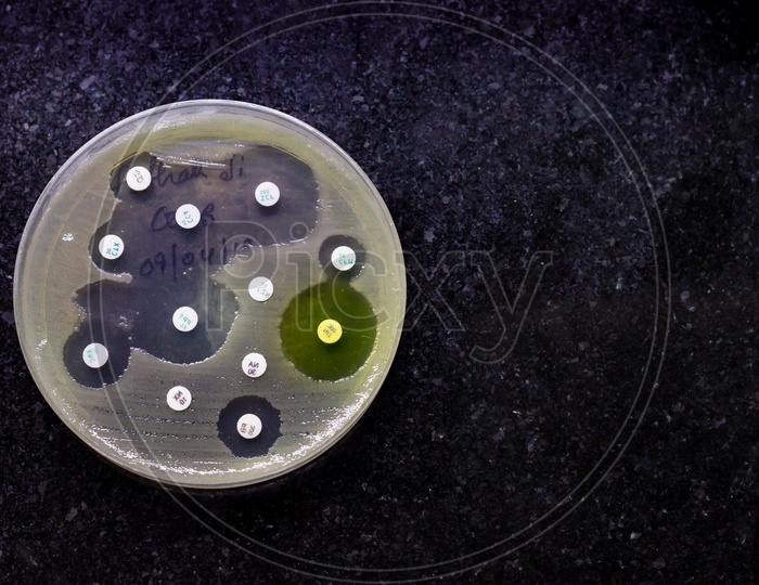 Top View Of Culture Plate Of Bacterial Growth Showing Antibiotic Sensitivity In Their Colony Pattern Placed On Mosaic Black Background