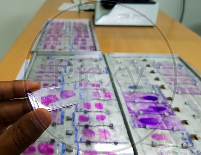 Hand Holding Histopathology Slides Stained With Leishman Stain With Selective Focus On Hand Held Slide