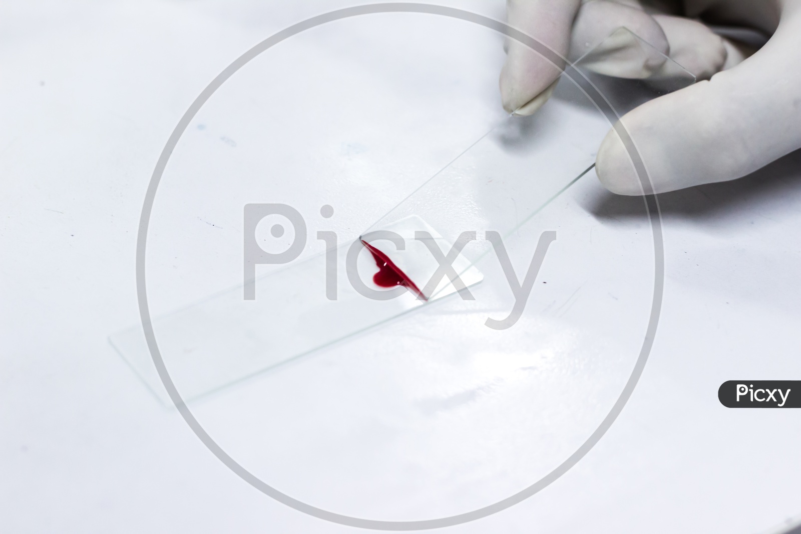 Smear Drawing Of Blood By Glass Slide