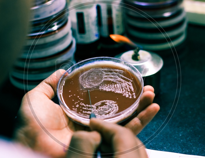 Bacterial Inoculation On A Culture Plate Using Inoculation Loop By Scientist Lab Technician In Microbiology Laboratory