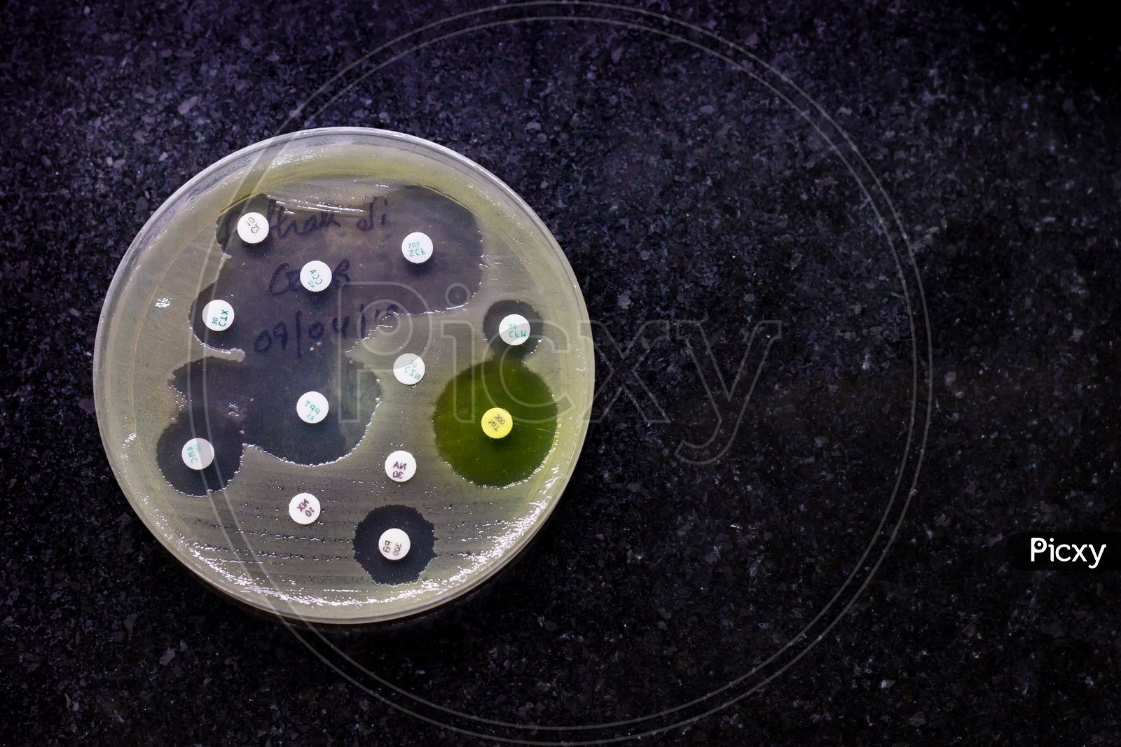 Top View Of Culture Plate Of Bacterial Growth Showing Antibiotic Sensitivity In Their Colony Pattern Placed On Mosaic Black Background