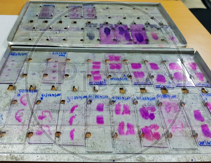 Histopathology Slides Stained With Leishman Stain, Displayed And Ready For Microscopy With Selective Focus On Slides