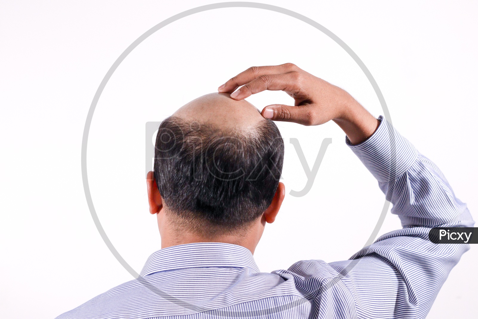Bald Businessman With His Head On Scalp View From Behind With White Background, Hair Loss