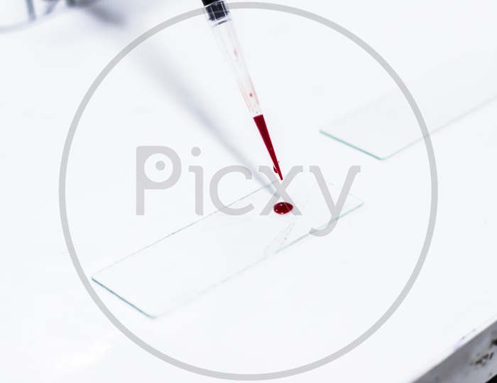 Drop Of Blood On A Glass Slide Using Micropipette Microtip