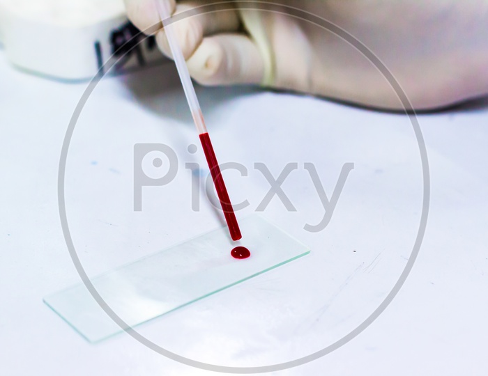 Scientist Dropping A Drop Of Blood On A Glass Slide
