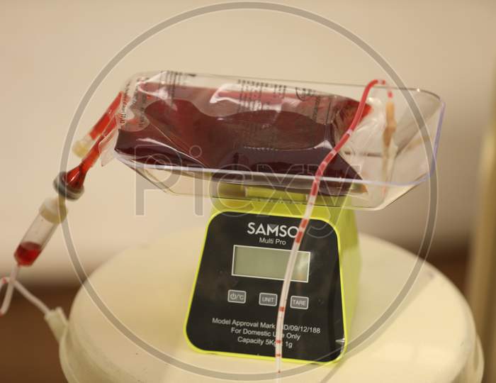 Collected blood in a bag
