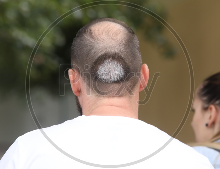 A Bald Man Head Closeup Shot