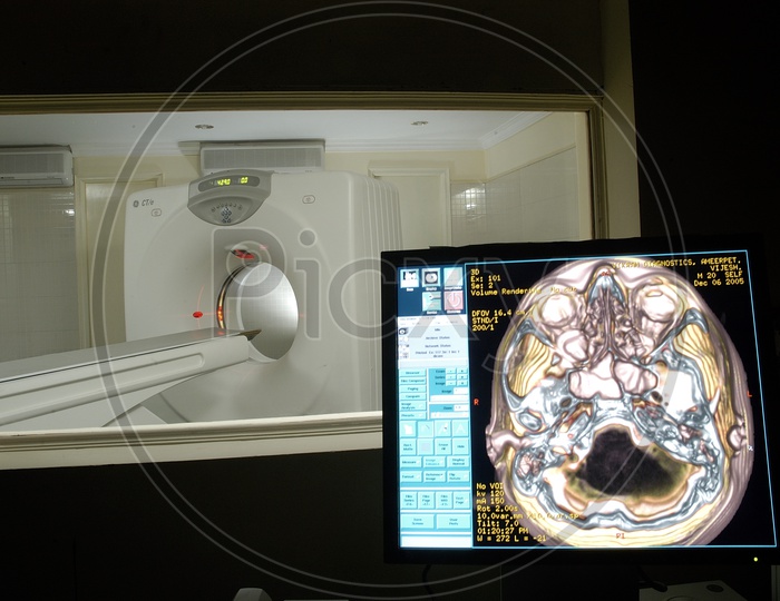 Photograph of CT Scan Machine with Monitor in foreground in a Hospital