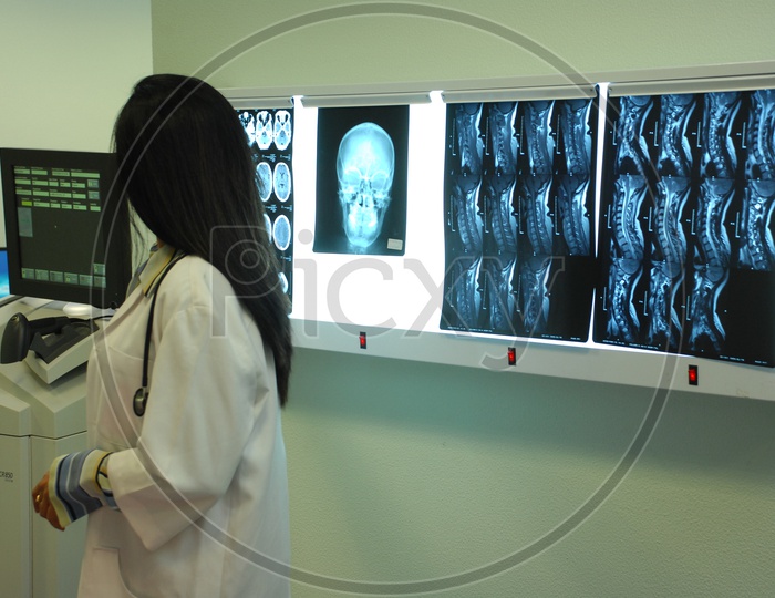 Doctor with  white coat and stethoscope checking the x-rays of the human skull - Movie scene