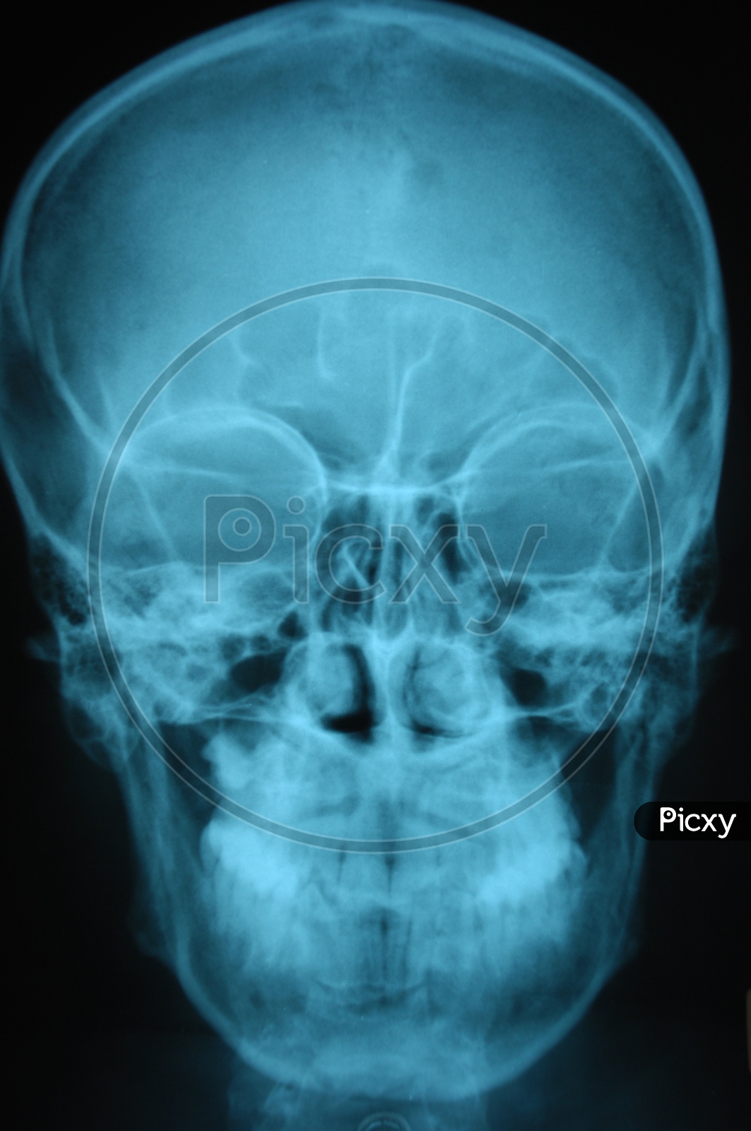 X-ray with a skeleton of a human head