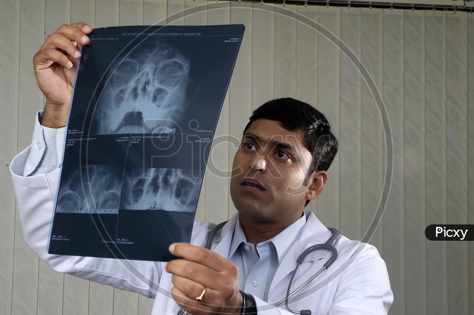 Doctor checking the x-ray