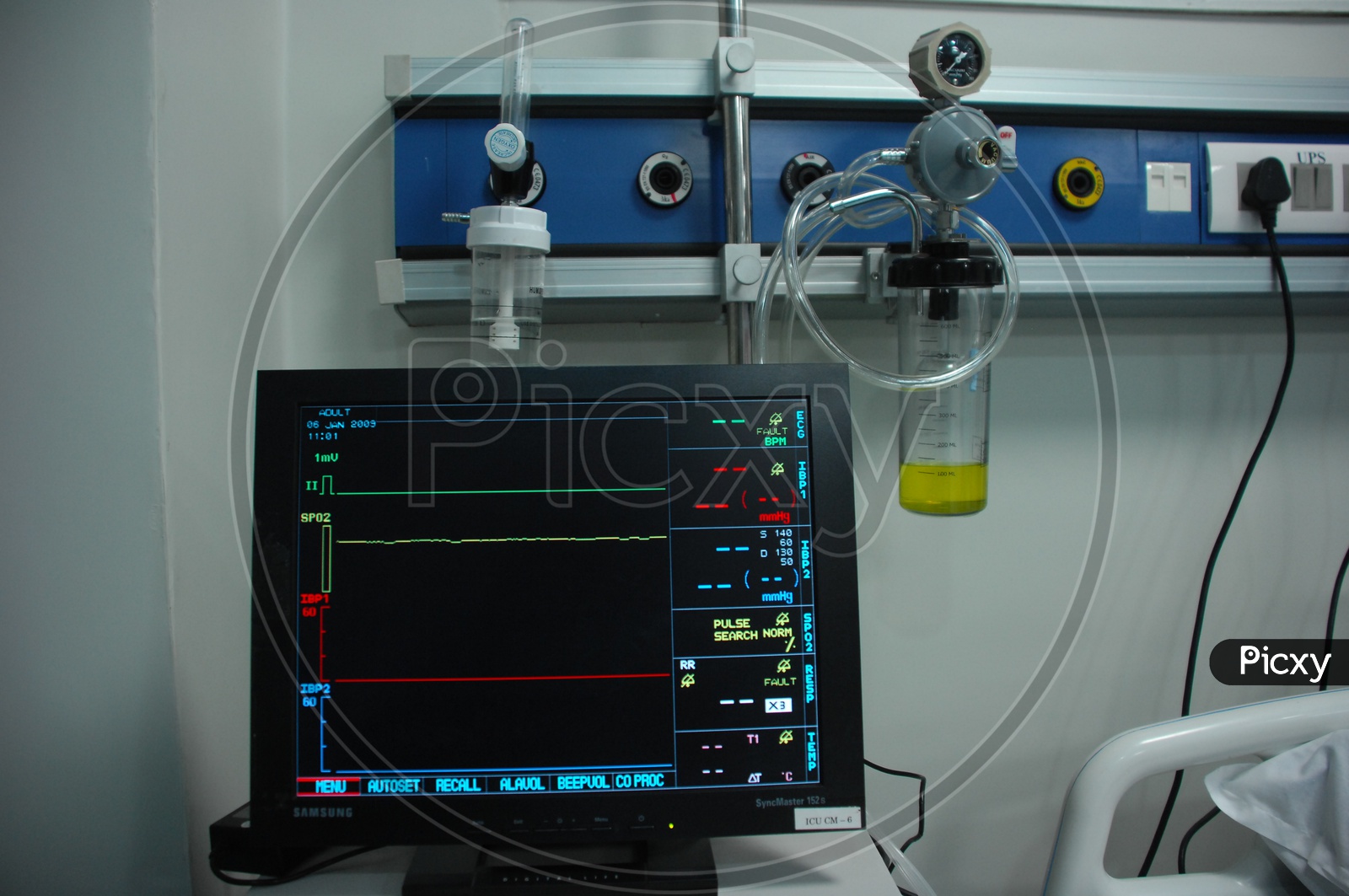 Heartbeat Monitoring Machine in Hospital