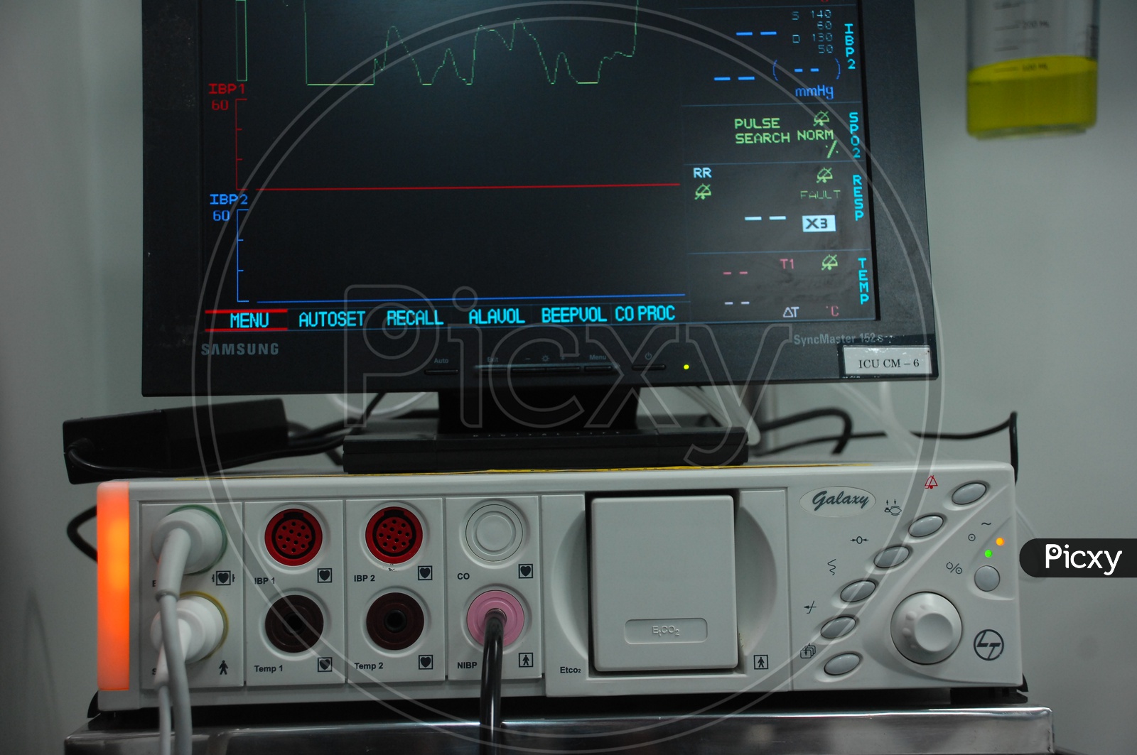 Heartbeat monitoring machine in a hospital