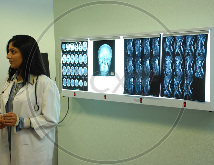 Doctor with  white coat and stethoscope checking the x-rays of the human skull