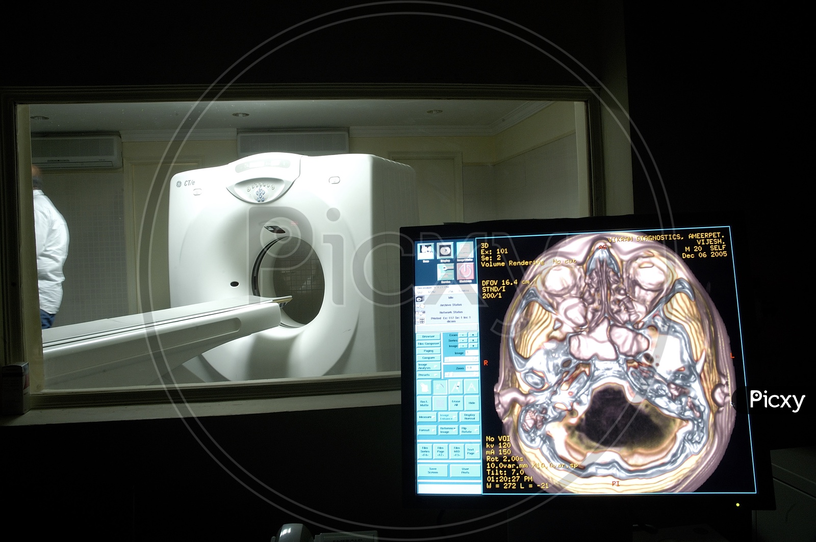 Photograph of CT Scan Machine with Monitor in foreground in a Hospital