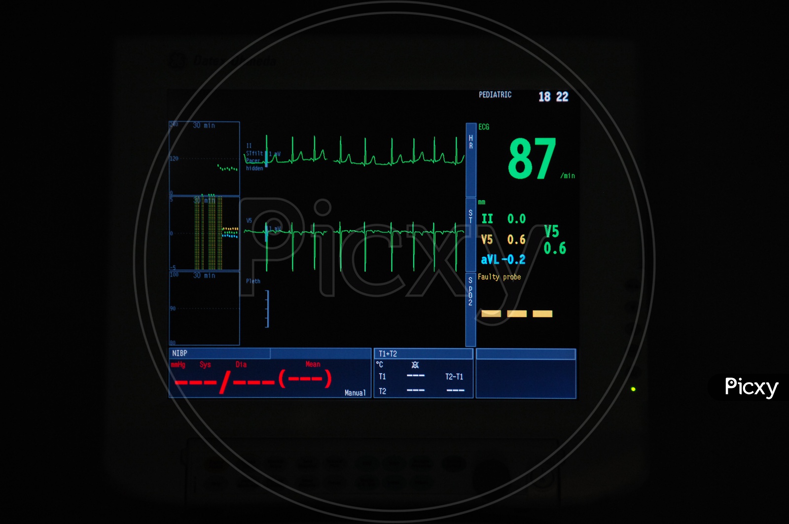 Medical Monitor Machine in Operation room