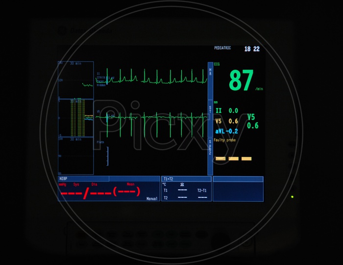 Medical Monitor Machine in Operation room