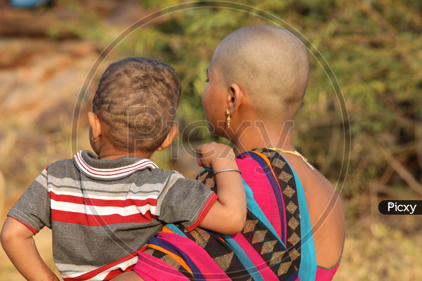A Mother And Her Child Bald