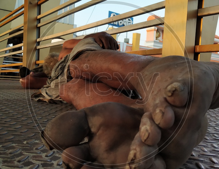 Bare feet of a beggar