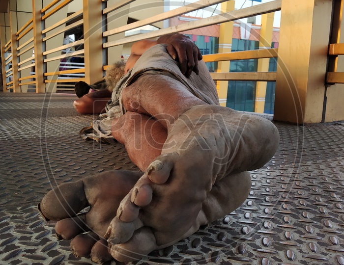 Bare feet of a beggar