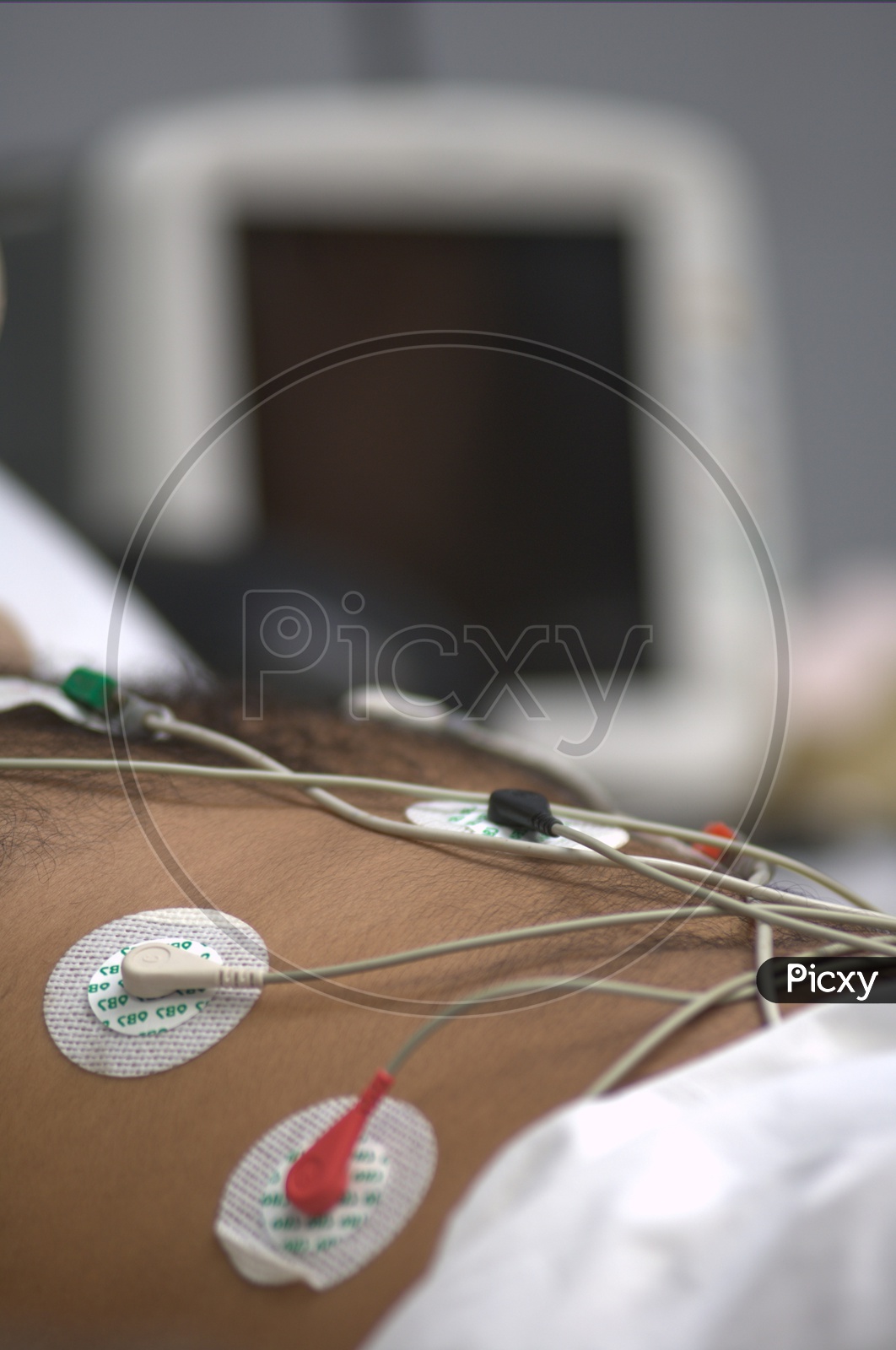 Patient with electrodes on chest