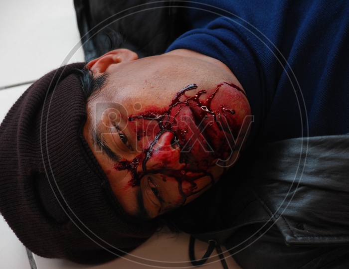 An unconscious man with injuries on face