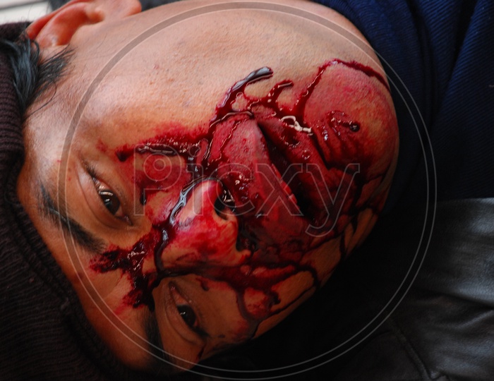 An unconscious man with injuries on face