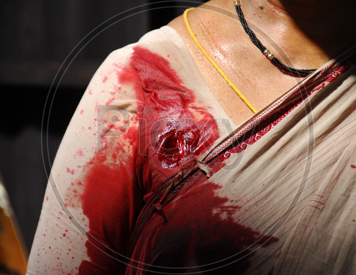 A woman with blood injury