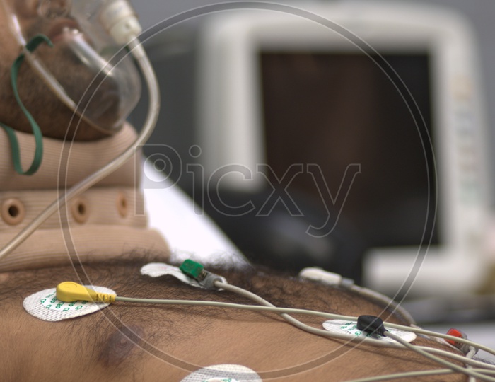 Patient with electrodes on chest in a hospital