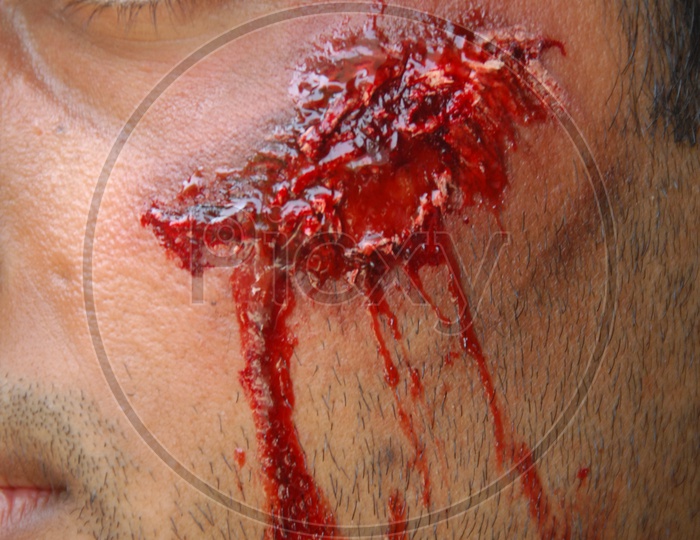 A man with blood injury on his face