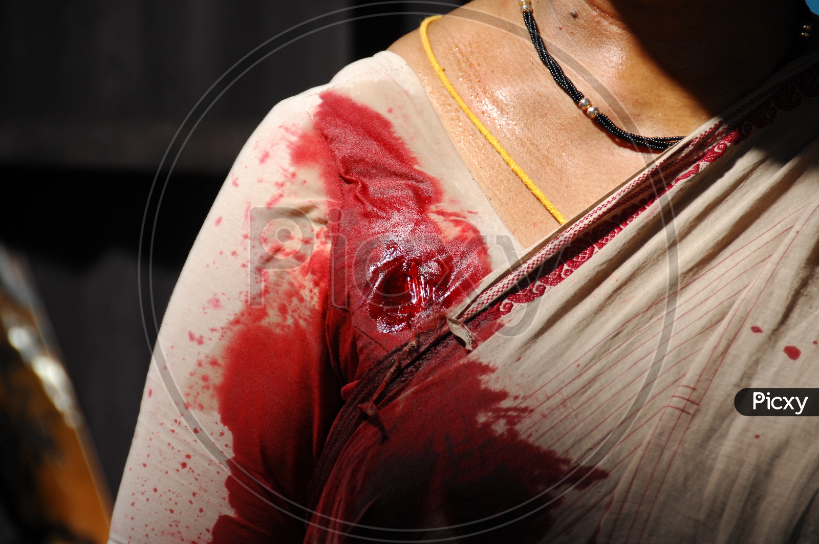 A woman with blood injury