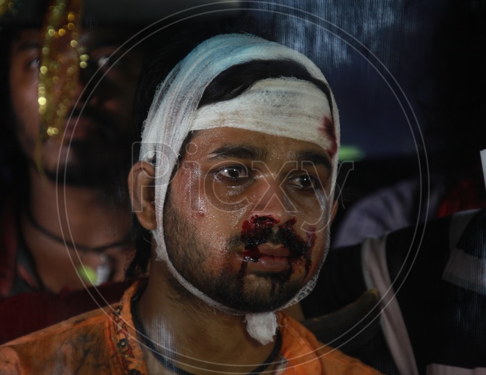 A Man With Blood Stains On Face and Bandage For Head Wounds