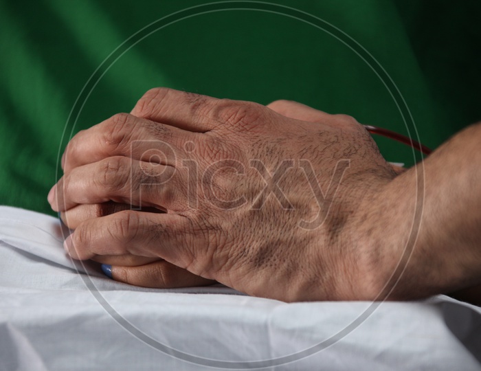 Patient Hand Closeup