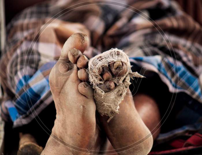 The feet of a road side beggars
