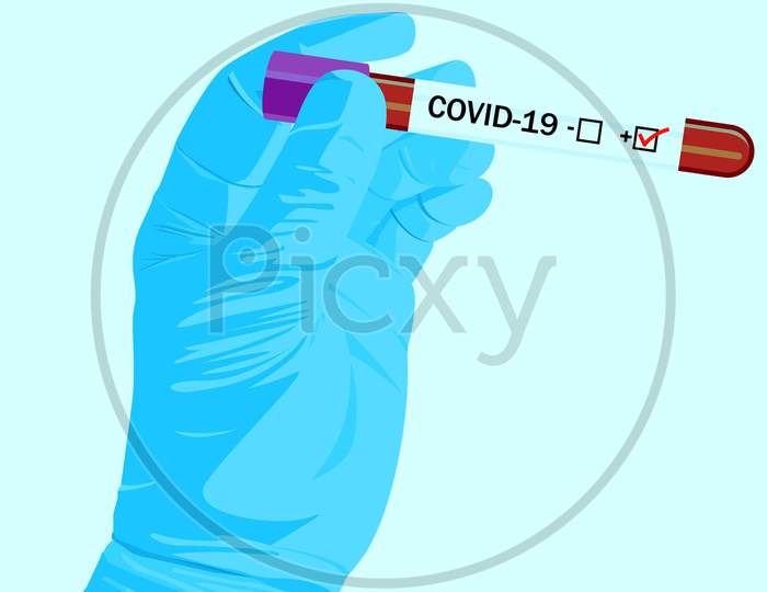 Test Tube In Hand With Corona Virus Positive.