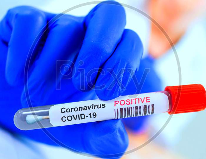 Corona Virus Infected Swab Test Sample In Doctor Hands. Covid-19 Epidemic And Virus Outbreak.